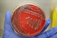 Photo of a petri dish
