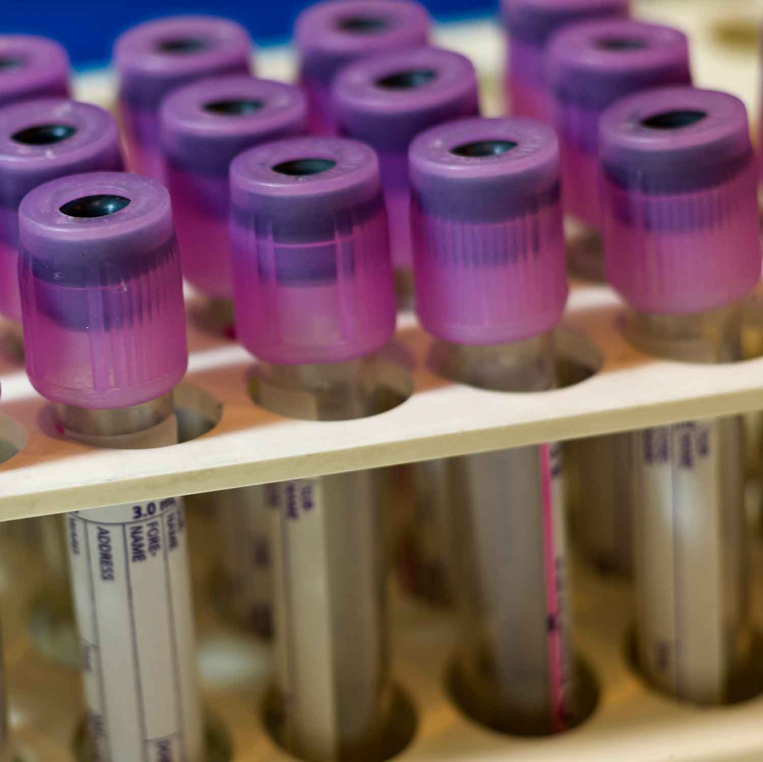 Close up of test tubes.