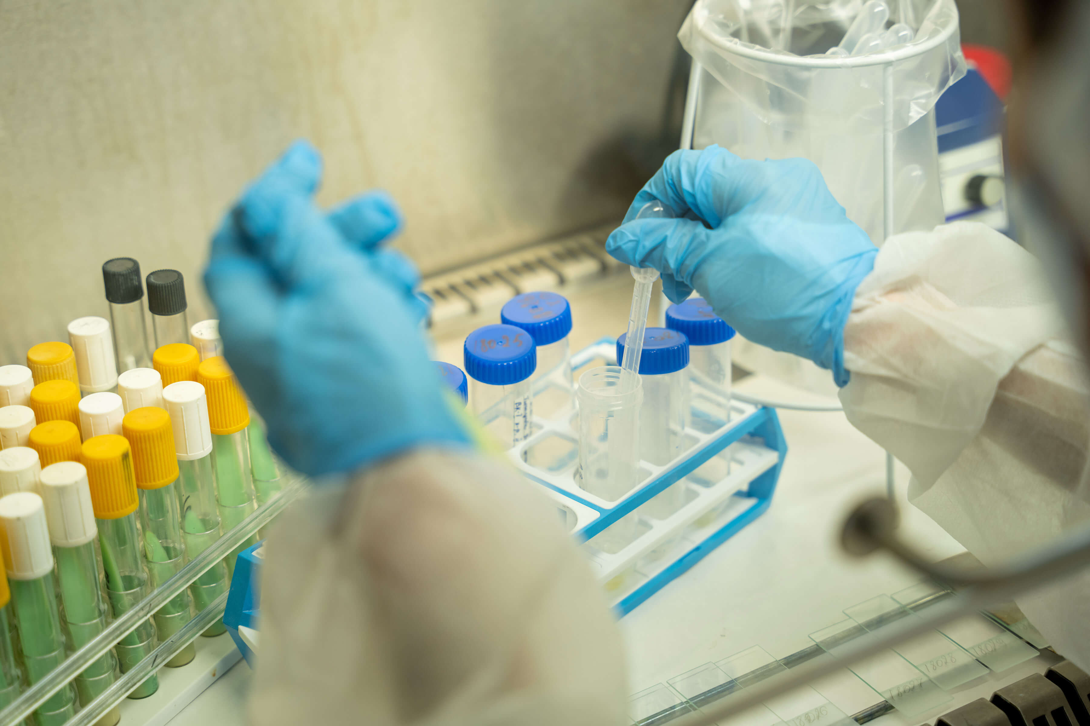 Scientist wearing PPE working with Tuberculosis samples in a laboratory