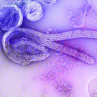 Close-up image of the Ebola virus